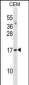 VPREB1 Antibody (Center)